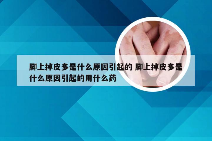 脚上掉皮多是什么原因引起的 脚上掉皮多是什么原因引起的用什么药