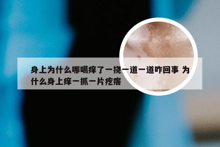 身上为什么哪噶痒了一挠一道一道咋回事 为什么身上痒一抓一片疙瘩
