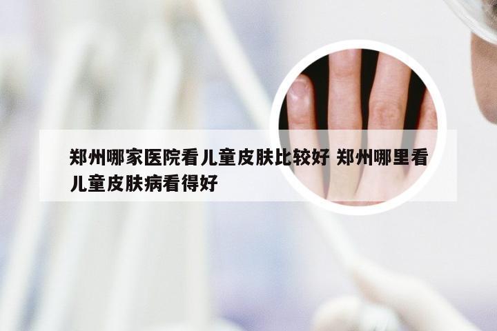 郑州哪家医院看儿童皮肤比较好 郑州哪里看儿童皮肤病看得好