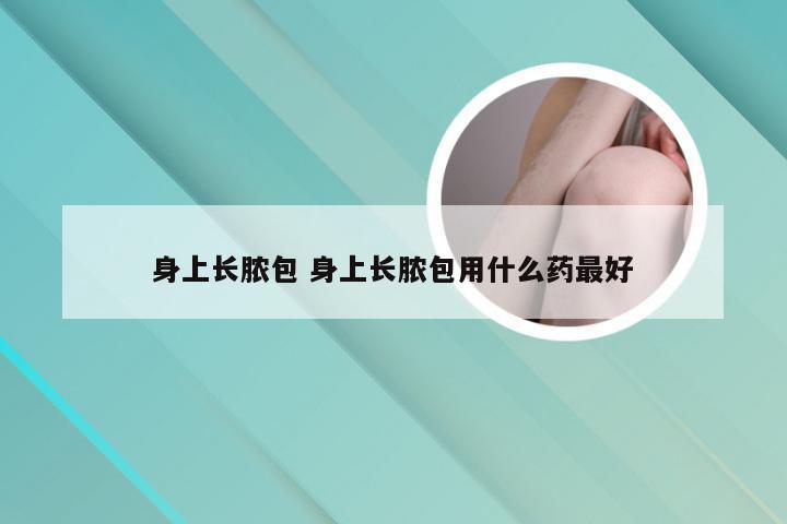 身上长脓包 身上长脓包用什么药最好