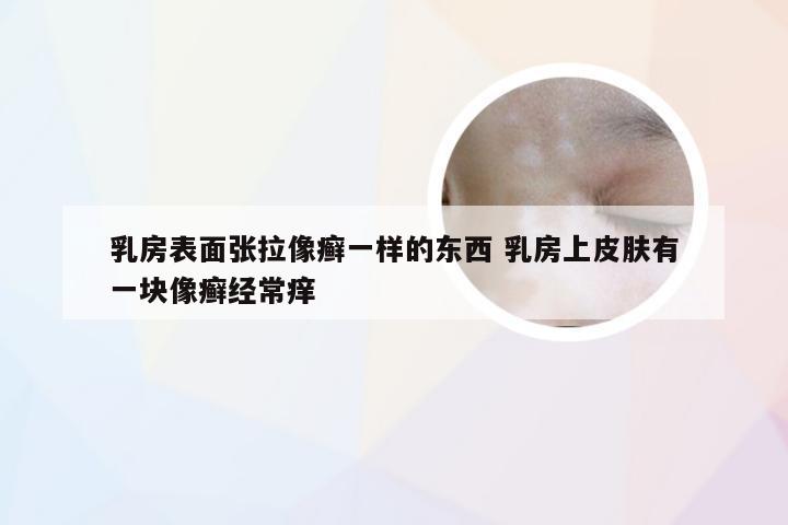 乳房表面张拉像癣一样的东西 乳房上皮肤有一块像癣经常痒