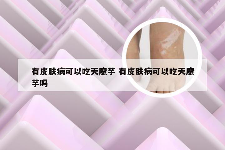 有皮肤病可以吃天魔芋 有皮肤病可以吃天魔芋吗