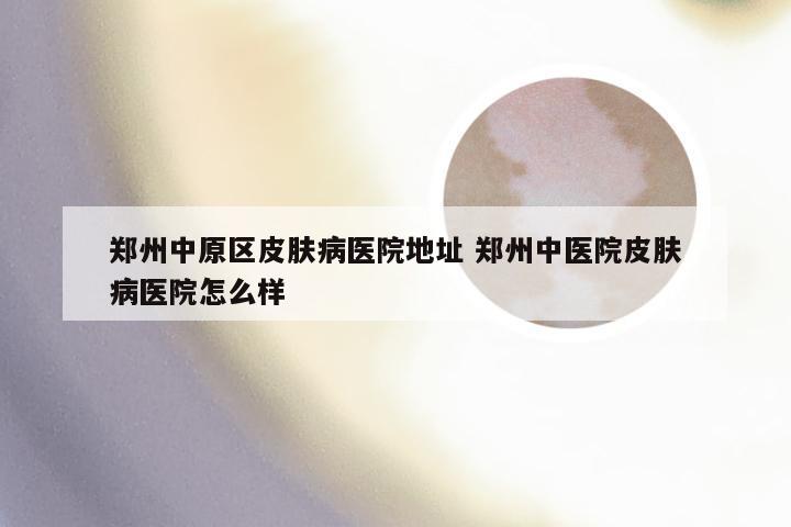 郑州中原区皮肤病医院地址 郑州中医院皮肤病医院怎么样