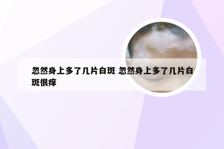 忽然身上多了几片白斑 忽然身上多了几片白斑很痒