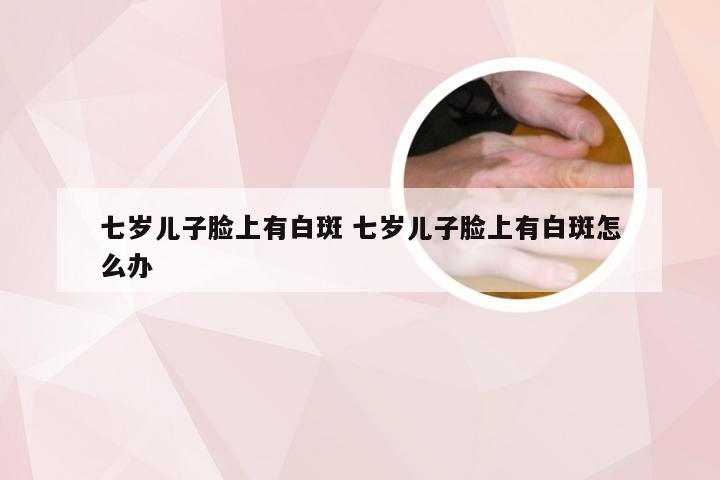 七岁儿子脸上有白斑 七岁儿子脸上有白斑怎么办