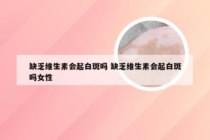 缺乏维生素会起白斑吗 缺乏维生素会起白斑吗女性