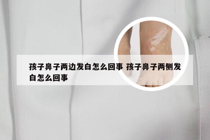孩子鼻子两边发白怎么回事 孩子鼻子两侧发白怎么回事