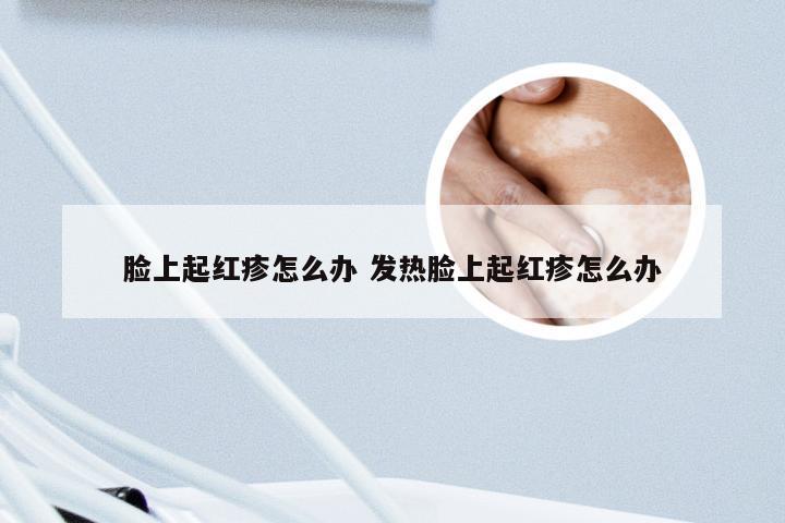 脸上起红疹怎么办 发热脸上起红疹怎么办