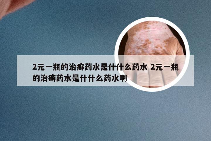 2元一瓶的治癣药水是什什么药水 2元一瓶的治癣药水是什什么药水啊