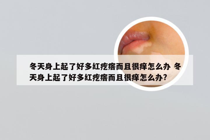 冬天身上起了好多红疙瘩而且很痒怎么办 冬天身上起了好多红疙瘩而且很痒怎么办?