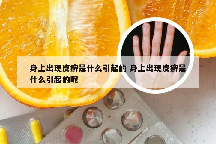 身上出现皮癣是什么引起的 身上出现皮癣是什么引起的呢