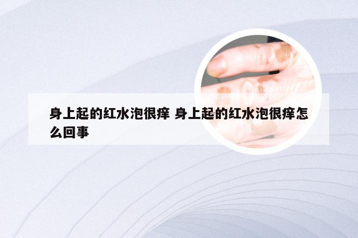 身上起的红水泡很痒 身上起的红水泡很痒怎么回事