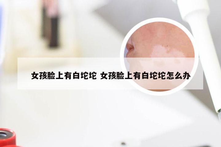女孩脸上有白坨坨 女孩脸上有白坨坨怎么办