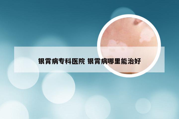 银霄病专科医院 银霄病哪里能治好