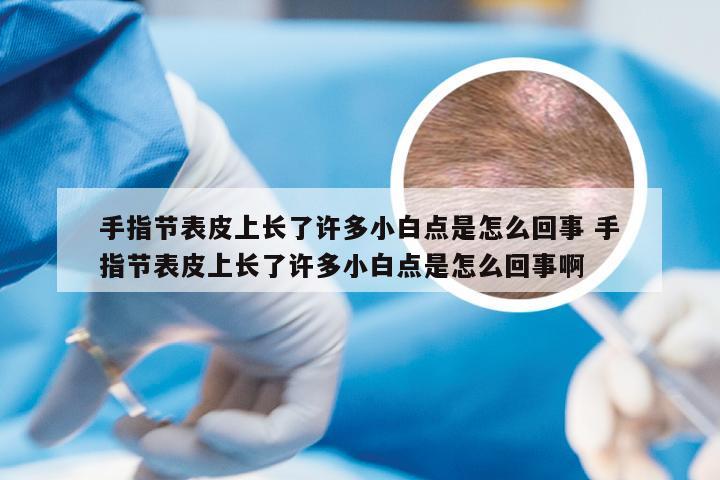 手指节表皮上长了许多小白点是怎么回事 手指节表皮上长了许多小白点是怎么回事啊