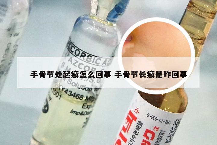 手骨节处起癣怎么回事 手骨节长癣是咋回事