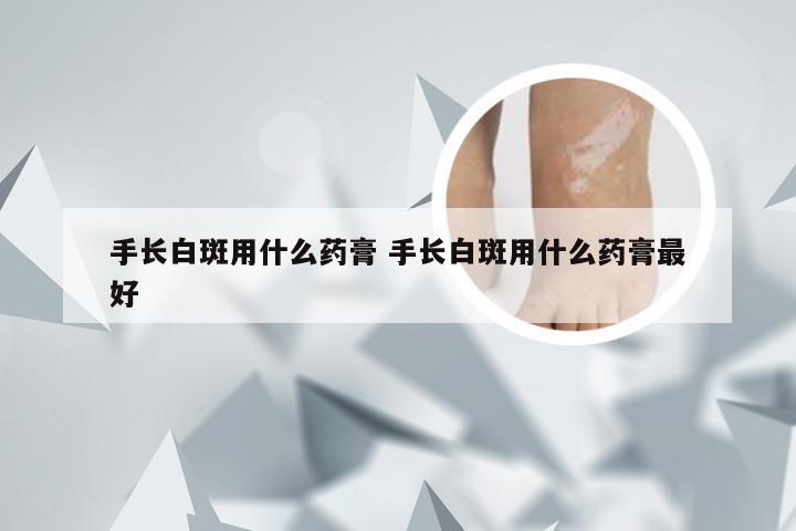 手长白斑用什么药膏 手长白斑用什么药膏最好