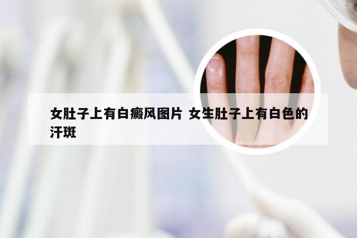 女肚子上有白癜风图片 女生肚子上有白色的汗斑