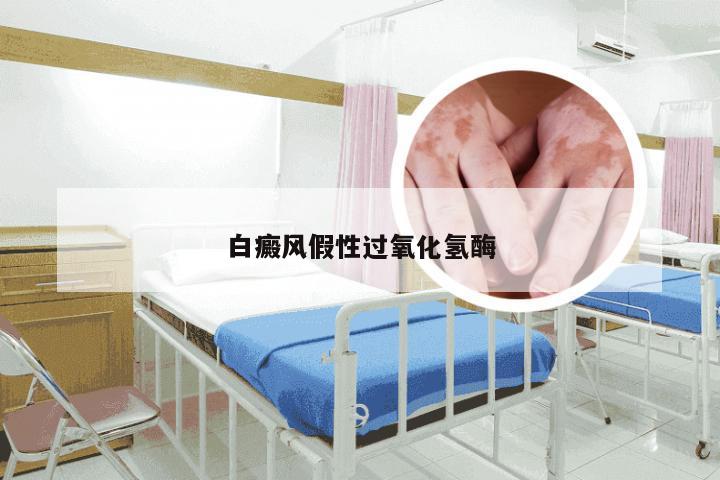 白癜风假性过氧化氢酶