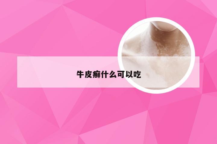 牛皮癣什么可以吃