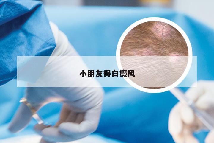 小朋友得白癜风