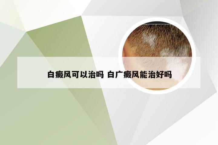 白癜风可以治吗 白广癜风能治好吗