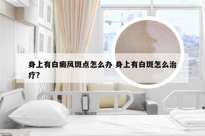 身上有白癜风斑点怎么办 身上有白斑怎么治疗?