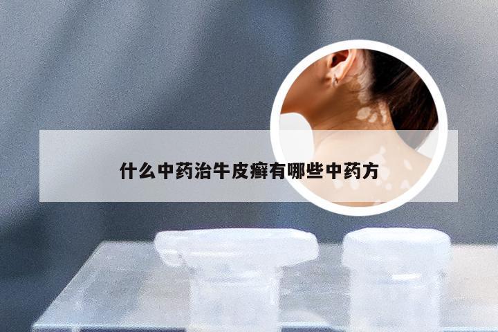 什么中药治牛皮癣有哪些中药方
