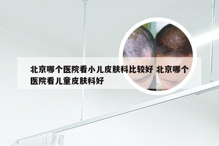 北京哪个医院看小儿皮肤科比较好 北京哪个医院看儿童皮肤科好
