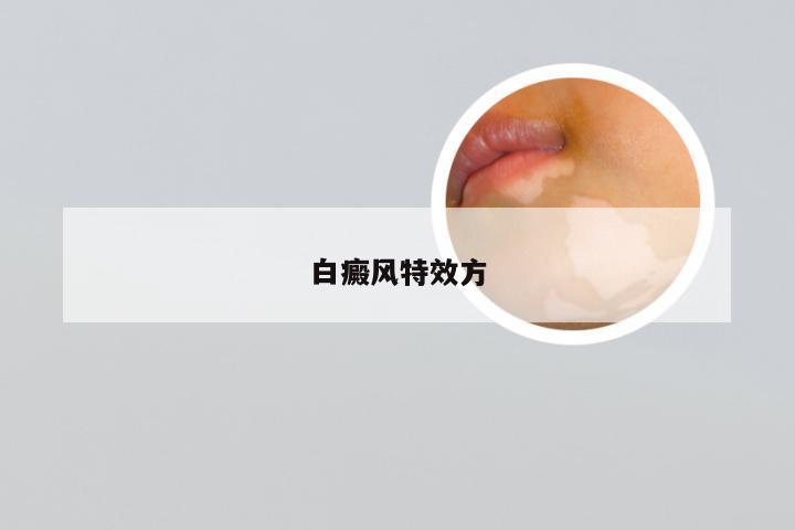 白癜风特效方
