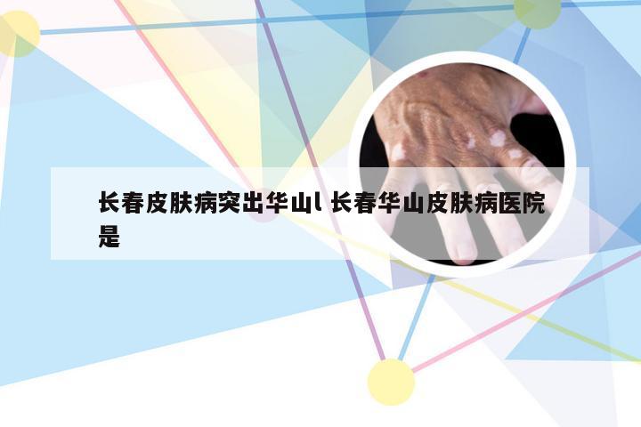 长春皮肤病突出华山l 长春华山皮肤病医院是