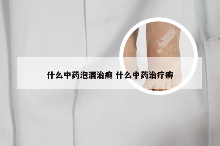 什么中药泡酒治癣 什么中药治疗癣