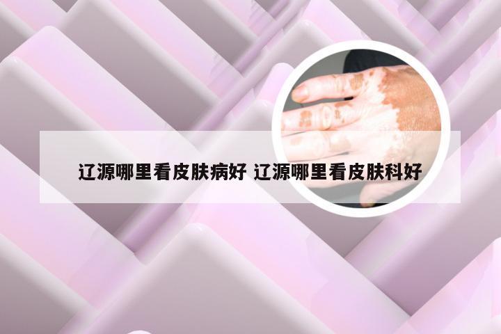 辽源哪里看皮肤病好 辽源哪里看皮肤科好