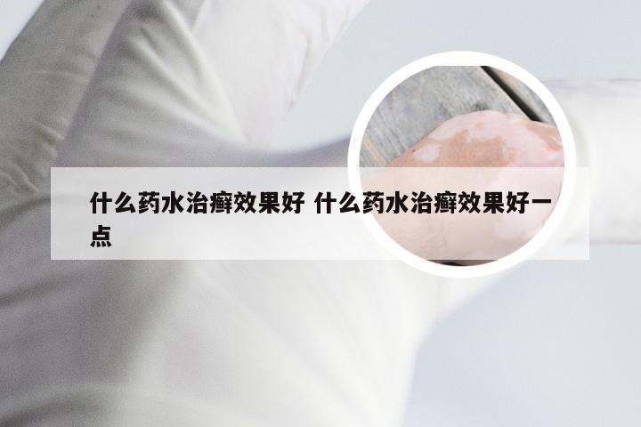 什么药水治癣效果好 什么药水治癣效果好一点