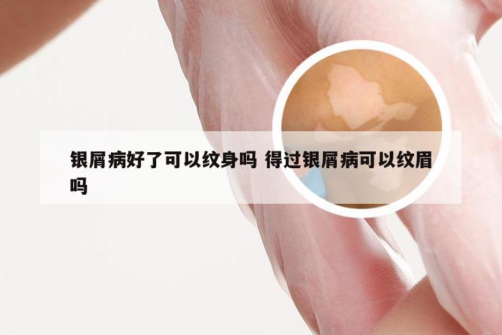 银屑病好了可以纹身吗 得过银屑病可以纹眉吗