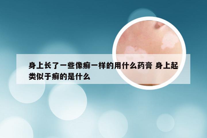 身上长了一些像癣一样的用什么药膏 身上起类似于癣的是什么