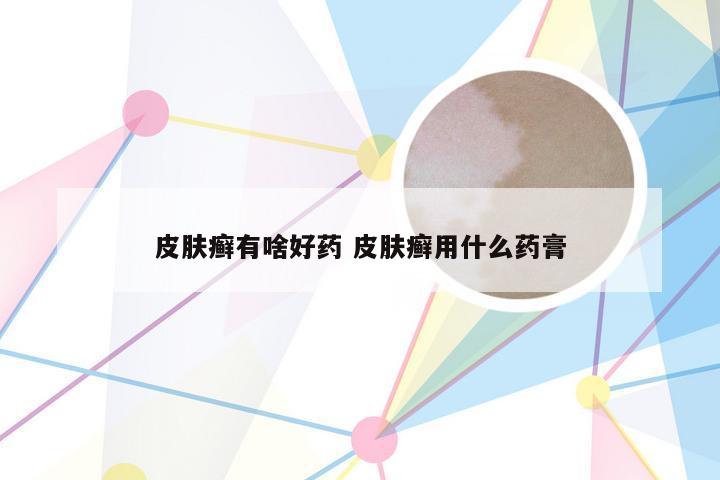 皮肤癣有啥好药 皮肤癣用什么药膏