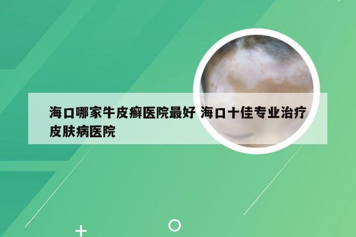 海口哪家牛皮癣医院最好 海口十佳专业治疗皮肤病医院