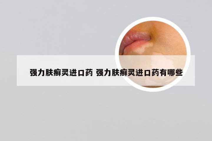 强力肤癣灵进口药 强力肤癣灵进口药有哪些