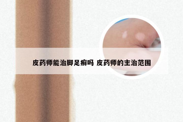 皮药师能治脚足癣吗 皮药师的主治范围