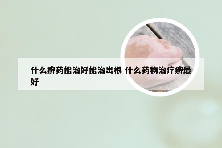 什么癣药能治好能治出根 什么药物治疗癣最好