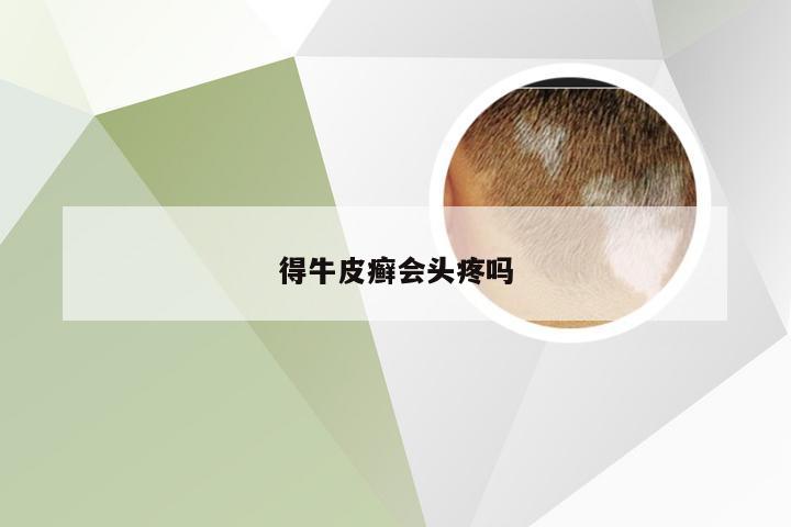 得牛皮癣会头疼吗