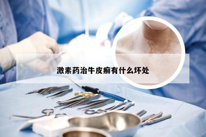 激素药治牛皮癣有什么坏处