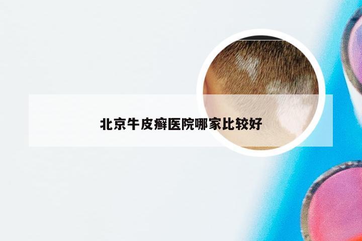 北京牛皮癣医院哪家比较好