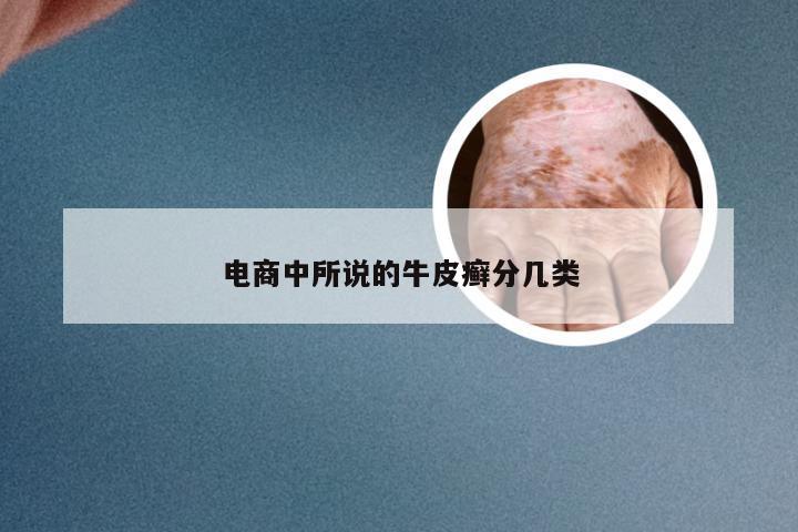 电商中所说的牛皮癣分几类