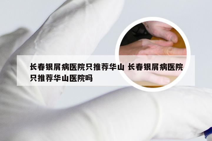 长春银屑病医院只推荐华山 长春银屑病医院只推荐华山医院吗