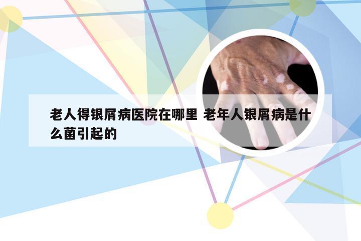老人得银屑病医院在哪里 老年人银屑病是什么菌引起的