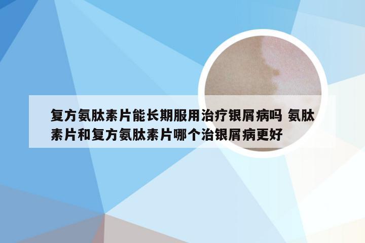 复方氨肽素片能长期服用治疗银屑病吗 氨肽素片和复方氨肽素片哪个治银屑病更好