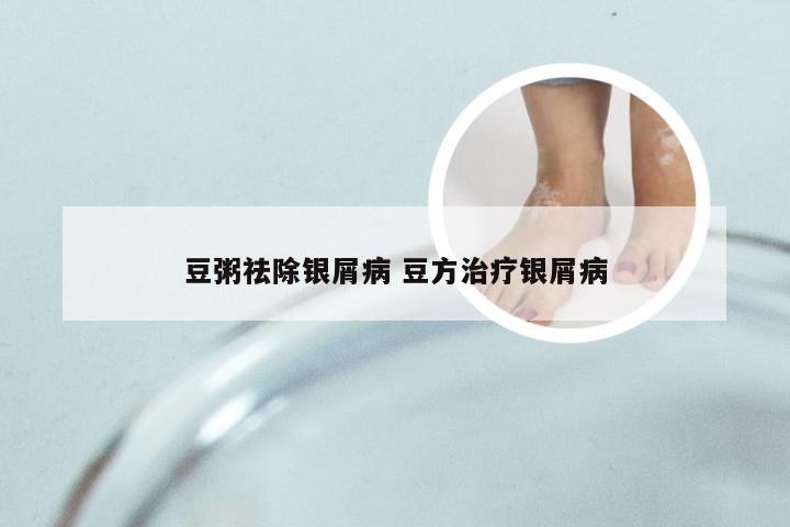 豆粥祛除银屑病 豆方治疗银屑病