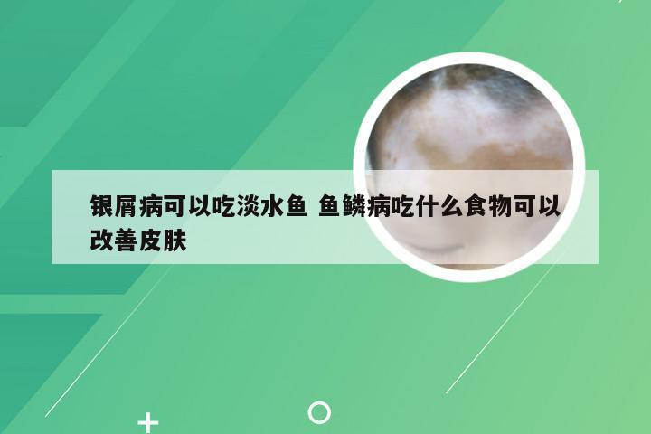银屑病可以吃淡水鱼 鱼鳞病吃什么食物可以改善皮肤